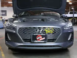 Afe - Advance Flow Engineering - 56-70005SE | aFe Power Dynamic Air Scoop (D.A.S.) (2018-2020 Elantra GT L4-1.6L t) - Image 3